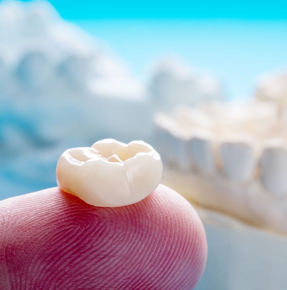 close up of a dental crown being held on dentist's finger