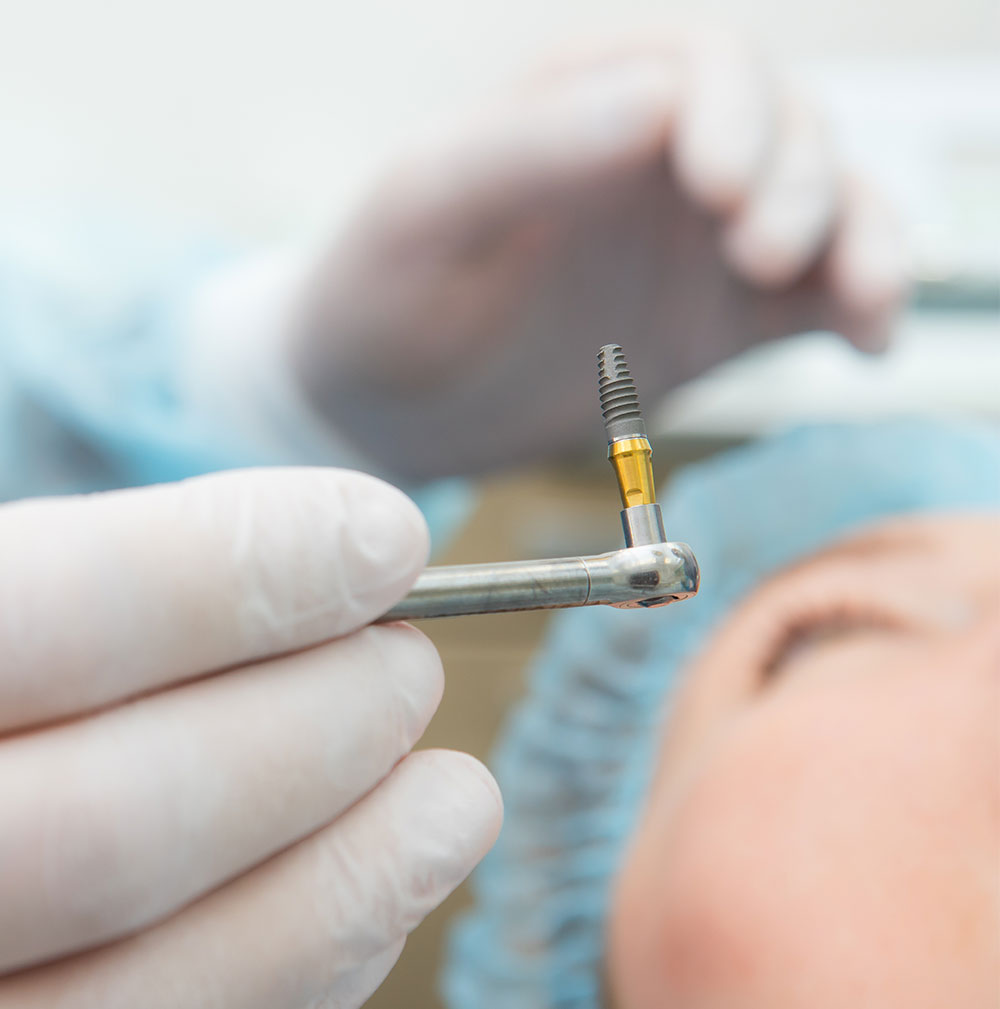 close up of dentist preparing to perform an implant restoration