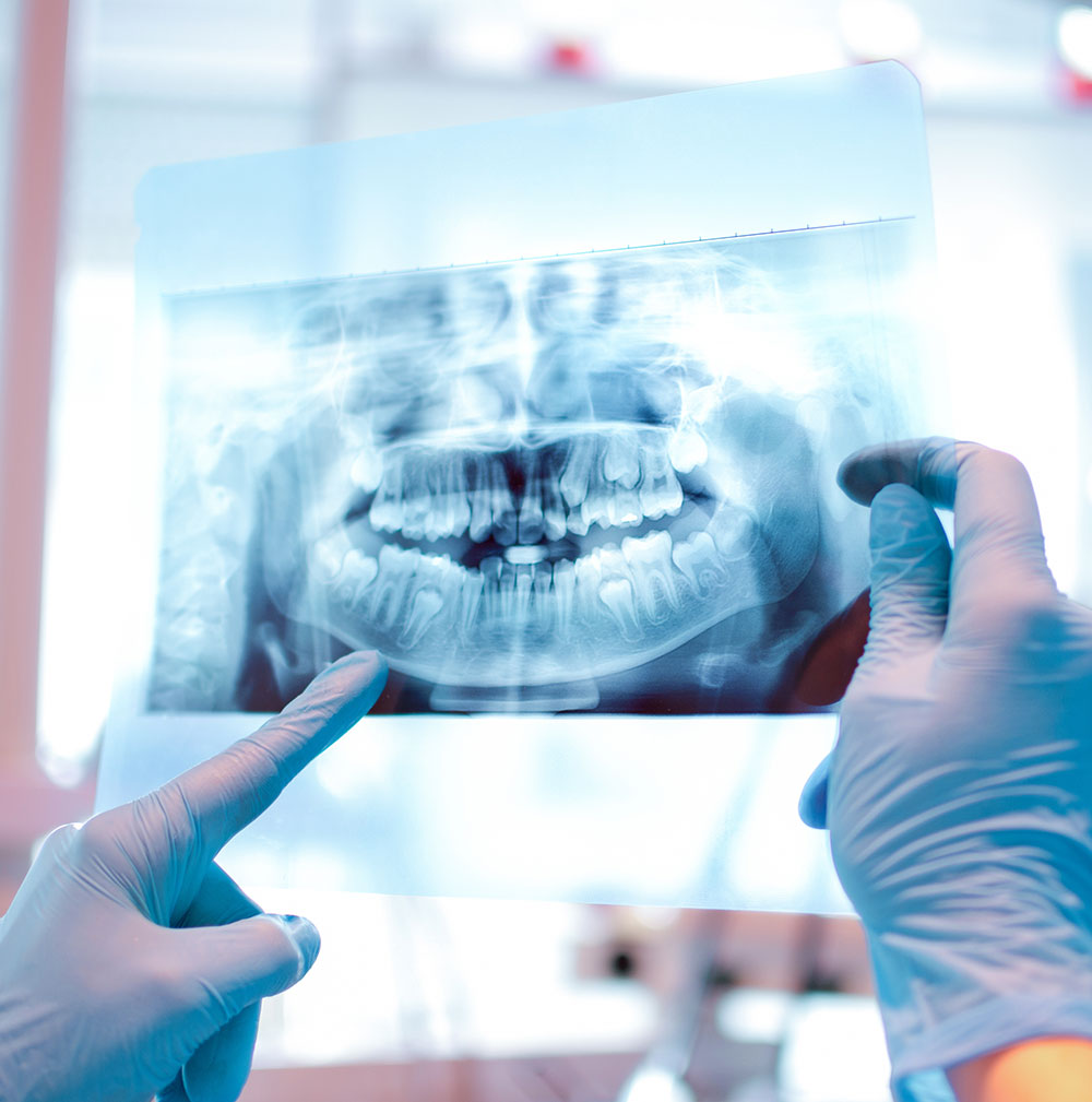 gloved hands holding up a digital dental x-ray